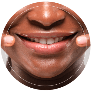 The Results Of A Lip Filler Treatment