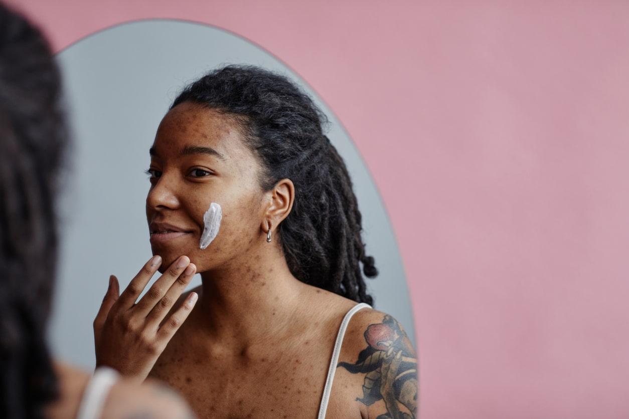 A young woman with acne scars putting product on her face in a mirror.