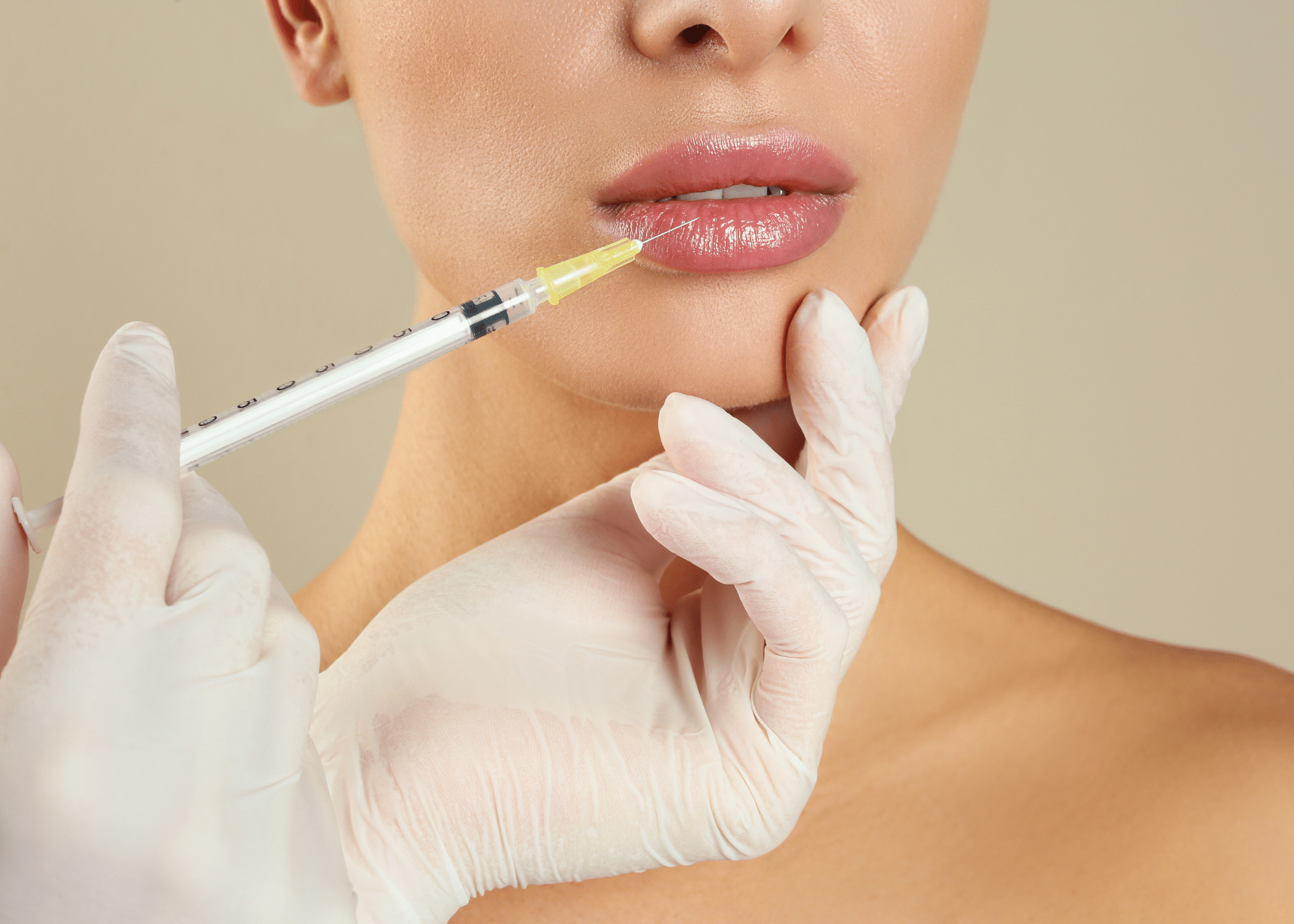 lip filler at halcyon