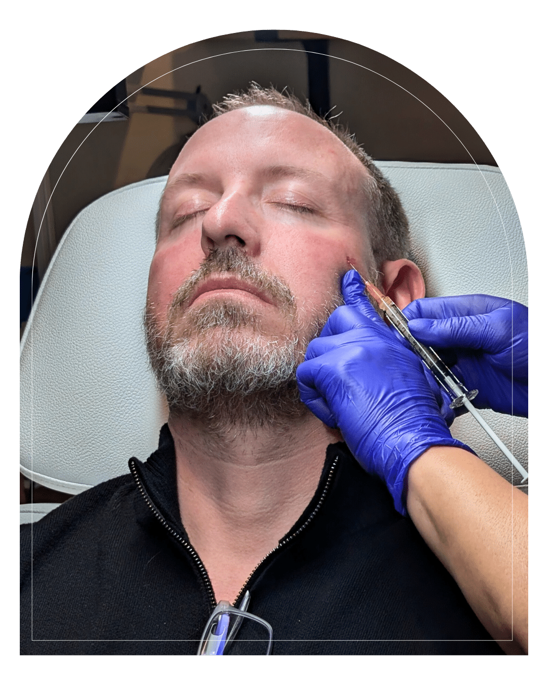 injectables at halcyon