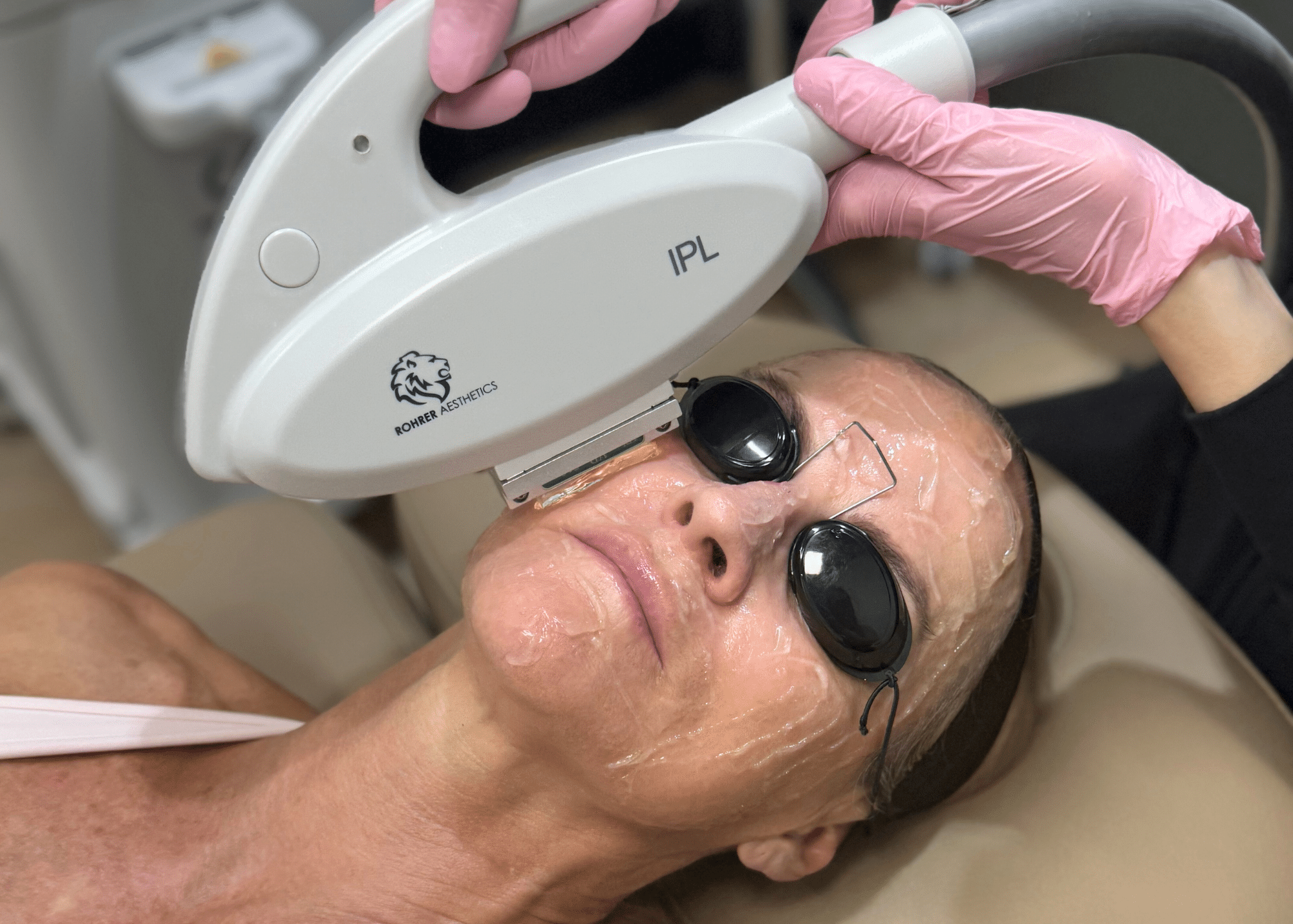 Woman getting a laser skin treatment